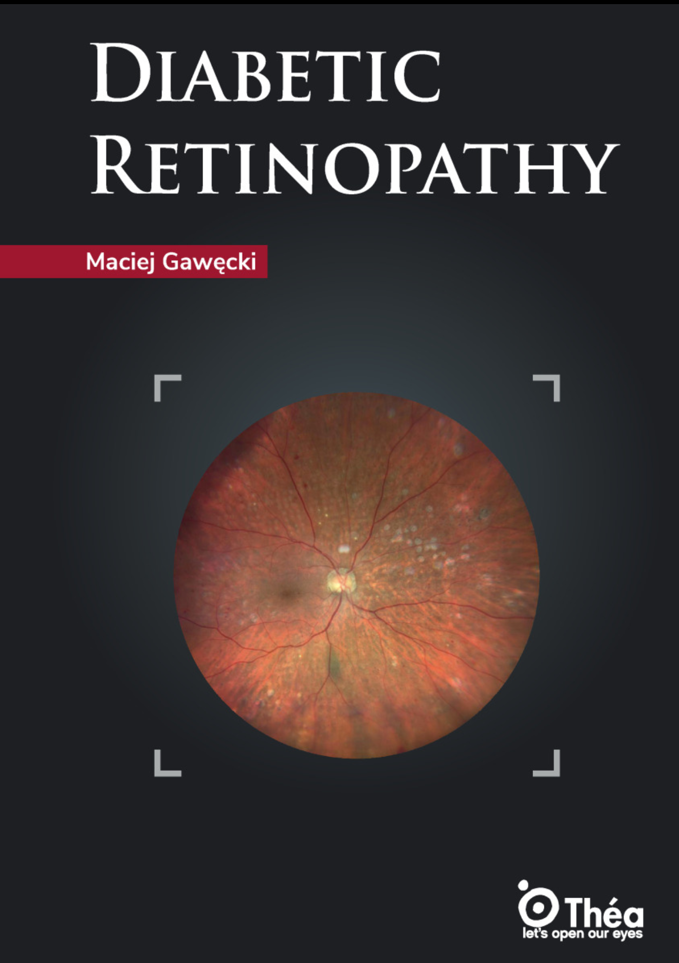 diabetic retinopathy