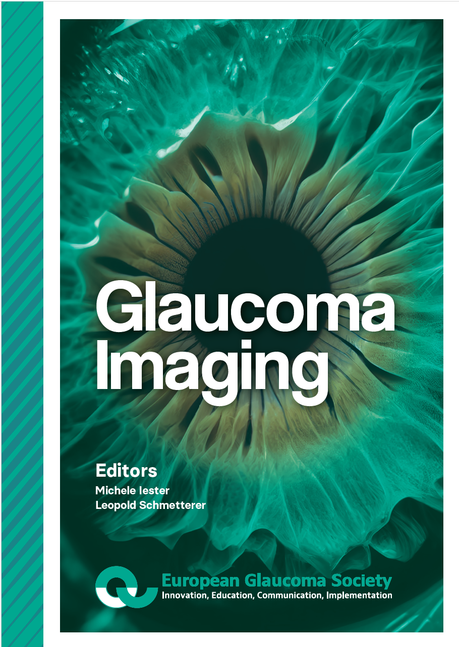 Glaucoma imaging