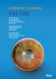 Chronic corneal ulcers