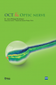 Oct & optic nerve