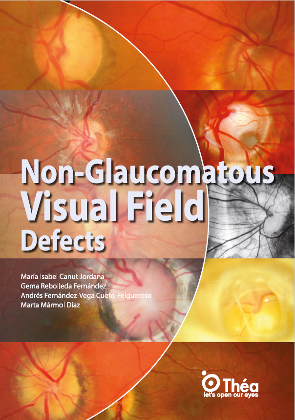 Non-glaucomatous visual field defects