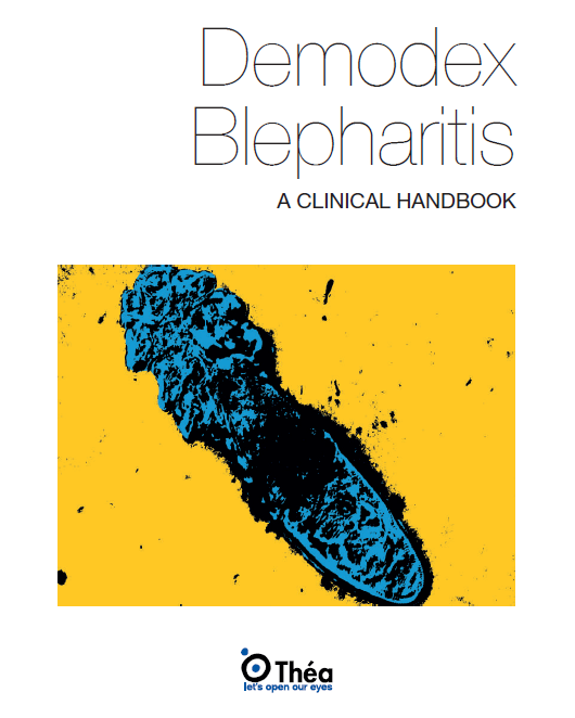 Demodex Blepharitis