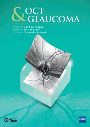 OCT and glaucoma: leveraging imaging for early diagnosis and management
