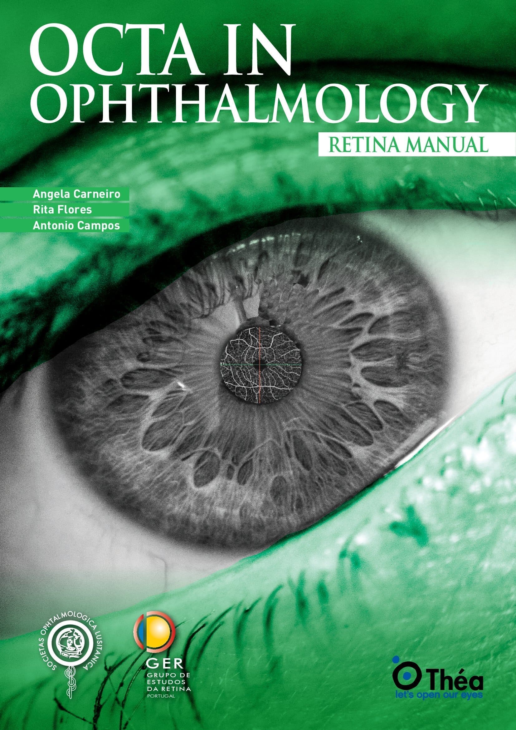 Octa in ophthalmology