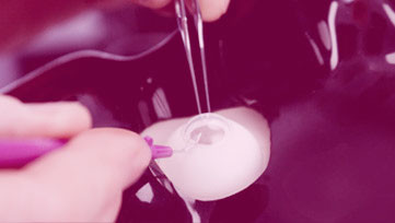Cataract surgery