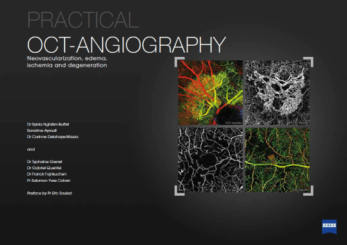 Practical OCT Angiography: a modern guide to retinal  imaging and clinical diagnosis