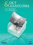 Oct și glaucomul