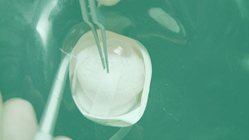 Strabismus